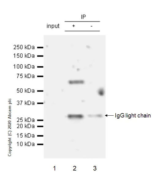 Immunoprecipitation - Anti-ROR alpha/RORA antibody [EPR23719-48] (AB278099)