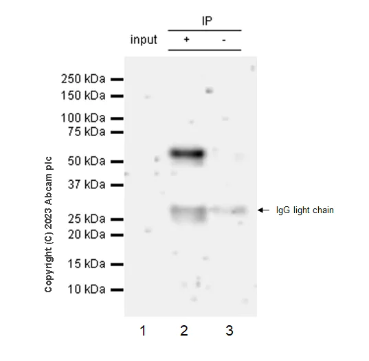 Immunoprecipitation - Anti-ROR alpha/RORA antibody [EPR23719-48] (AB278099)