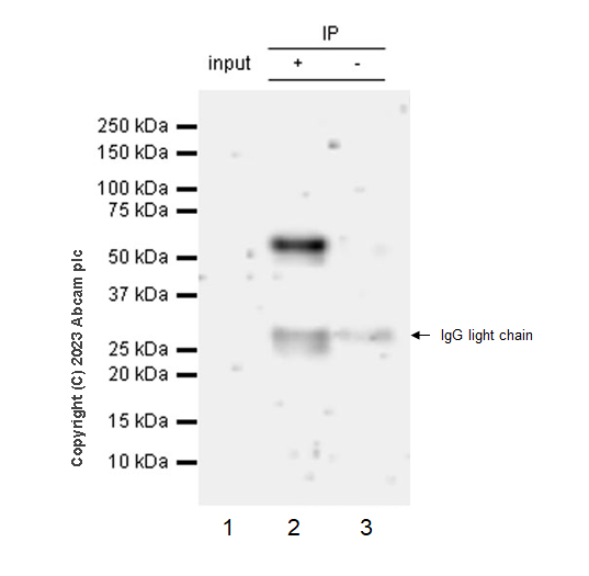 Immunoprecipitation - Anti-ROR alpha/RORA antibody [EPR23719-48] - BSA and Azide free (ab278109), expandable thumbnail