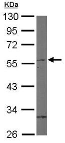 Western blot - Anti-ROR beta/RORB antibody (AB154889)
