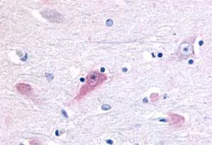Immunohistochemistry (Formalin/PFA-fixed paraffin-embedded sections) - Anti-ROR beta/RORB antibody (AB188756)