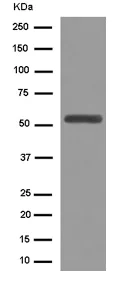 Western blot - Anti-ROR beta/RORB antibody [EPR15552] - N-terminal (AB187657)