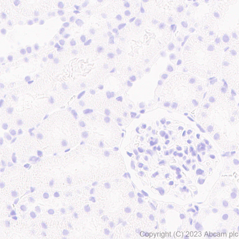Immunohistochemistry (Formalin/PFA-fixed paraffin-embedded sections) - Anti-ROR beta/RORB antibody [EPR27136-55] (AB314650)