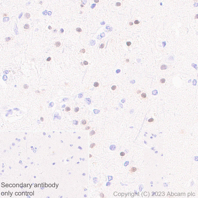 Immunohistochemistry (Formalin/PFA-fixed paraffin-embedded sections) - Anti-ROR beta/RORB antibody [EPR27136-55] (AB314650)