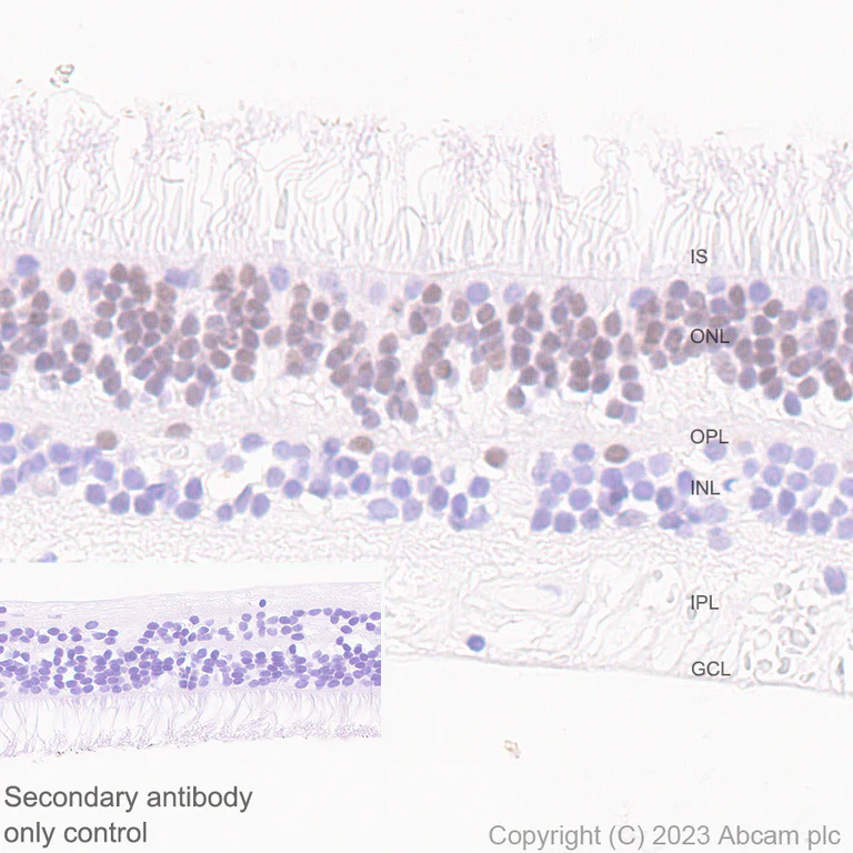Immunohistochemistry (Formalin/PFA-fixed paraffin-embedded sections) - Anti-ROR beta/RORB antibody [EPR27136-55] (AB314650)