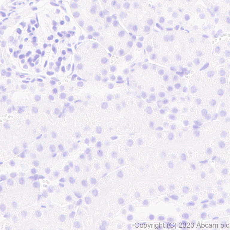 Immunohistochemistry (Formalin/PFA-fixed paraffin-embedded sections) - Anti-ROR beta/RORB antibody [EPR27136-55] (AB314650)