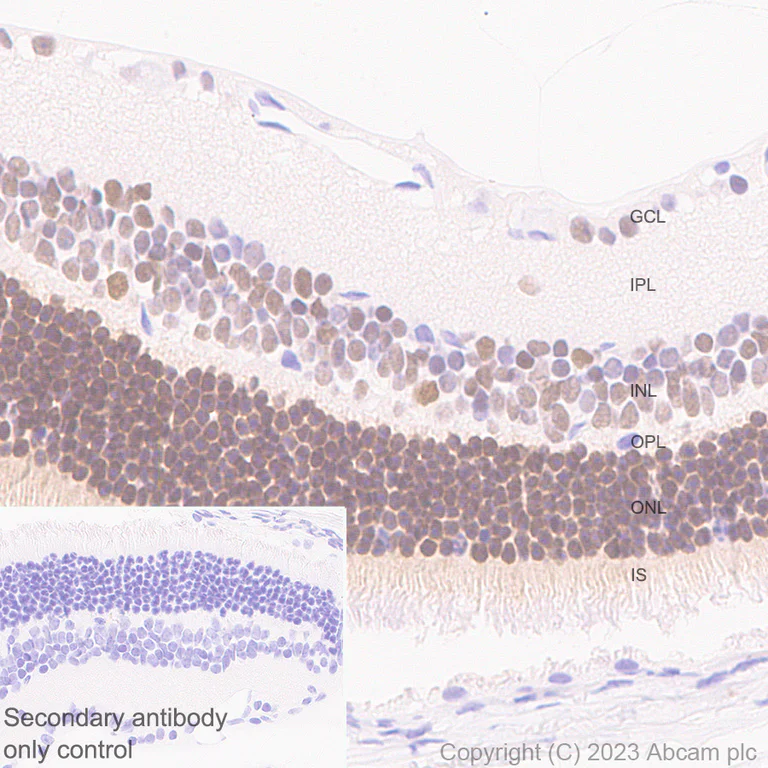 Immunohistochemistry (Formalin/PFA-fixed paraffin-embedded sections) - Anti-ROR beta/RORB antibody [EPR27136-55] (AB314650)