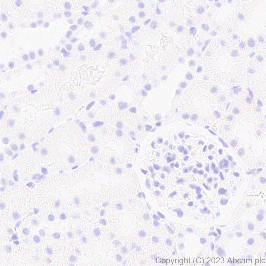 Immunohistochemistry (Formalin/PFA-fixed paraffin-embedded sections) - Anti-ROR beta/RORB antibody [EPR27136-55] - BSA and Azide free (AB314651), expandable thumbnail