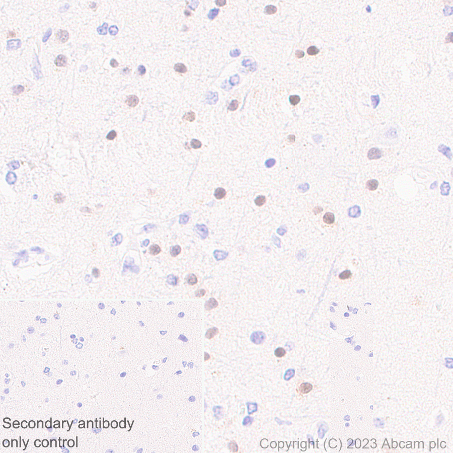 Immunohistochemistry (Formalin/PFA-fixed paraffin-embedded sections) - Anti-ROR beta/RORB antibody [EPR27136-55] - BSA and Azide free (ab314651), expandable thumbnail