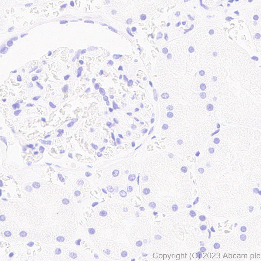 Immunohistochemistry (Formalin/PFA-fixed paraffin-embedded sections) - Anti-ROR beta/RORB antibody [EPR27136-55] - BSA and Azide free (ab314651), expandable thumbnail