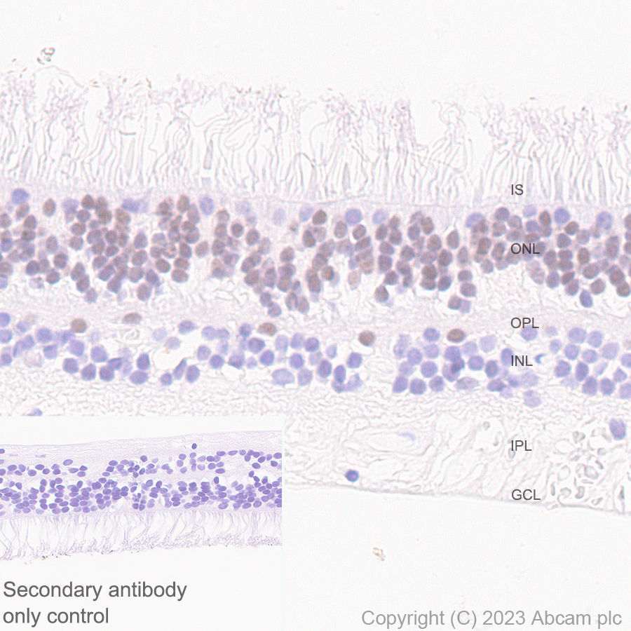 Immunohistochemistry (Formalin/PFA-fixed paraffin-embedded sections) - Anti-ROR beta/RORB antibody [EPR27136-55] - BSA and Azide free (ab314651), expandable thumbnail