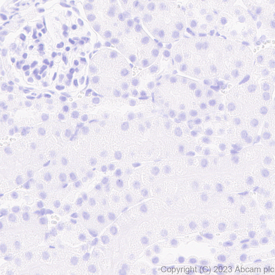 Immunohistochemistry (Formalin/PFA-fixed paraffin-embedded sections) - Anti-ROR beta/RORB antibody [EPR27136-55] - BSA and Azide free (AB314651), expandable thumbnail
