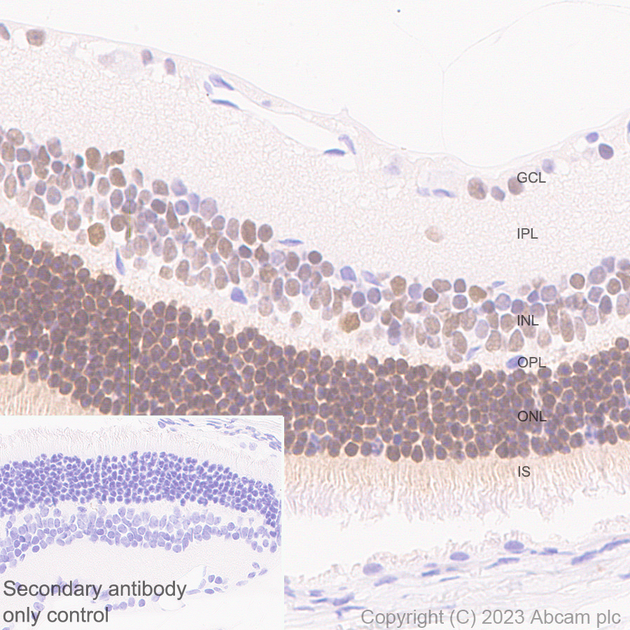 Immunohistochemistry (Formalin/PFA-fixed paraffin-embedded sections) - Anti-ROR beta/RORB antibody [EPR27136-55] - BSA and Azide free (ab314651), expandable thumbnail