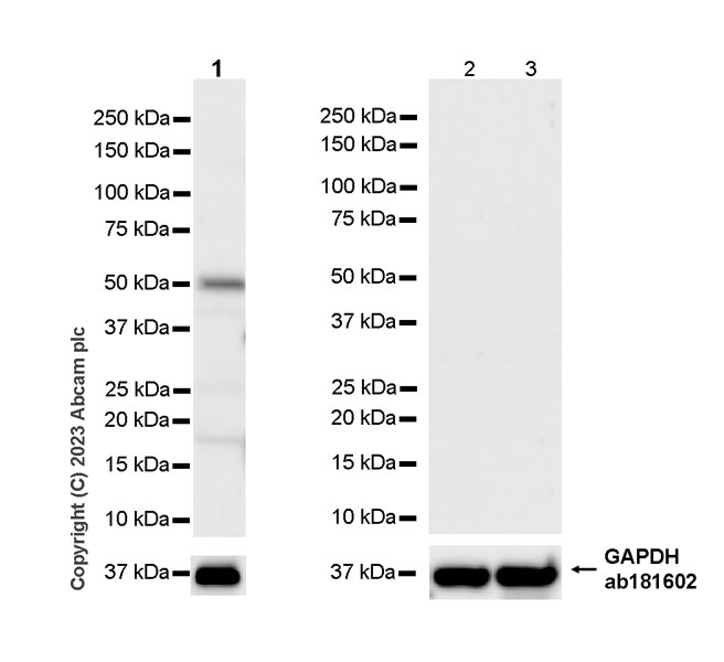 Western blot - Anti-ROR beta/RORB antibody [EPR27136-55] - BSA and Azide free (AB314651), expandable thumbnail