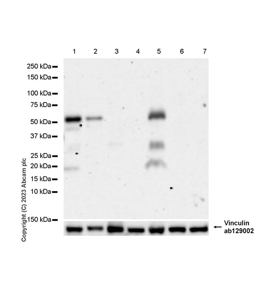 Western blot - Anti-ROR beta/RORB antibody [EPR27136-55] - BSA and Azide free (AB314651), expandable thumbnail