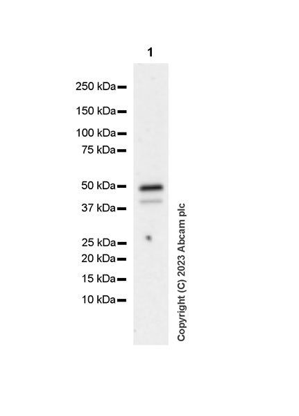 Western blot - Anti-ROR beta/RORB antibody [EPR27136-55] - BSA and Azide free (AB314651), expandable thumbnail