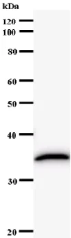 Western blot - Anti-ROR gamma antibody [162C2a] (AB58670)