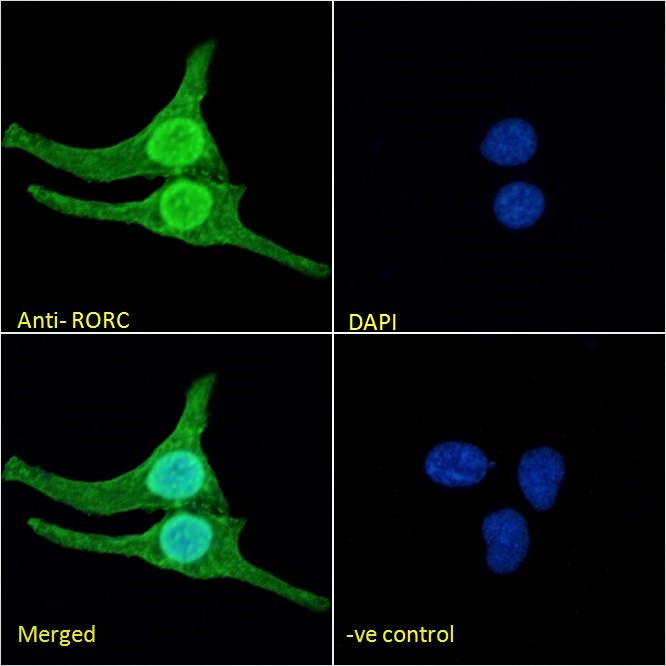 Immunocytochemistry/ Immunofluorescence - Anti-ROR gamma antibody (AB113434), expandable thumbnail