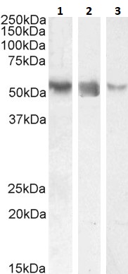 Western blot - Anti-ROR gamma antibody (AB113434), expandable thumbnail