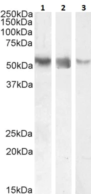 Anti-ROR gamma antibody (ab113434) | Abcam