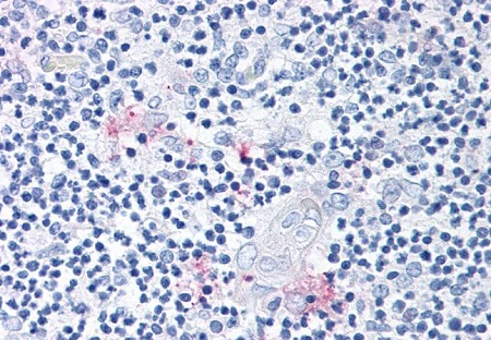 Immunohistochemistry (Formalin/PFA-fixed paraffin-embedded sections) - Anti-ROR gamma antibody (AB219501), expandable thumbnail