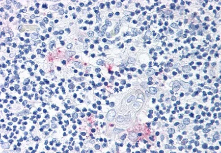 Immunohistochemistry (Formalin/PFA-fixed paraffin-embedded sections) - Anti-ROR gamma antibody (AB219501)