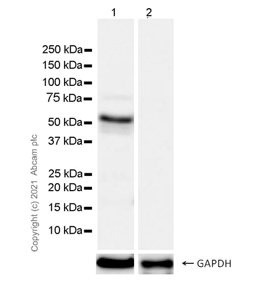 Western blot - Anti-ROR gamma antibody [Q31-378] - BSA and Azide free (AB289562)