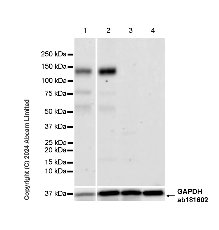Western blot - Anti-ROR1 antibody [6D4] (AB321998)