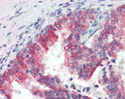 Immunohistochemistry (Formalin/PFA-fixed paraffin-embedded sections) - Anti-ROR1 antibody (AB111174)