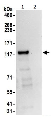 Immunoprecipitation - Anti-ROR2 antibody (AB245456)