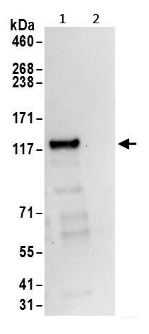 Immunoprecipitation - Anti-ROR2 antibody (AB245456)