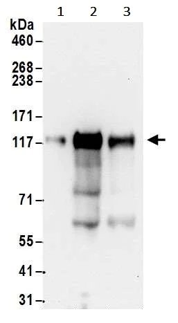 Western blot - Anti-ROR2 antibody (AB245456)