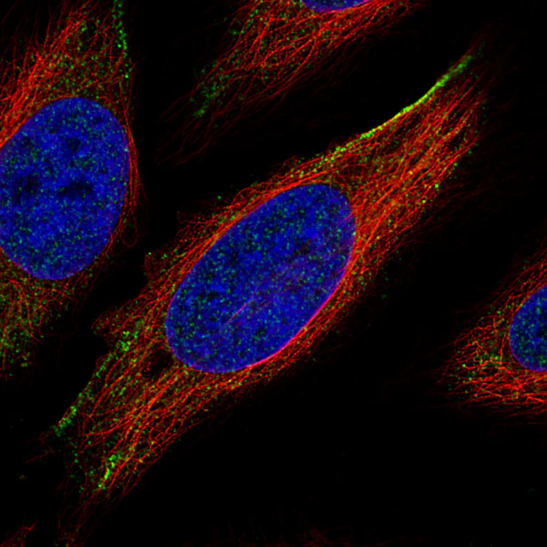 Immunocytochemistry/ Immunofluorescence - Anti-ROR2 Antibody [CL5950] (AB327120)