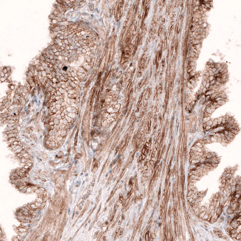 Immunohistochemistry (Formalin/PFA-fixed paraffin-embedded sections) - Anti-ROR2 Antibody [CL5950] (AB327120)