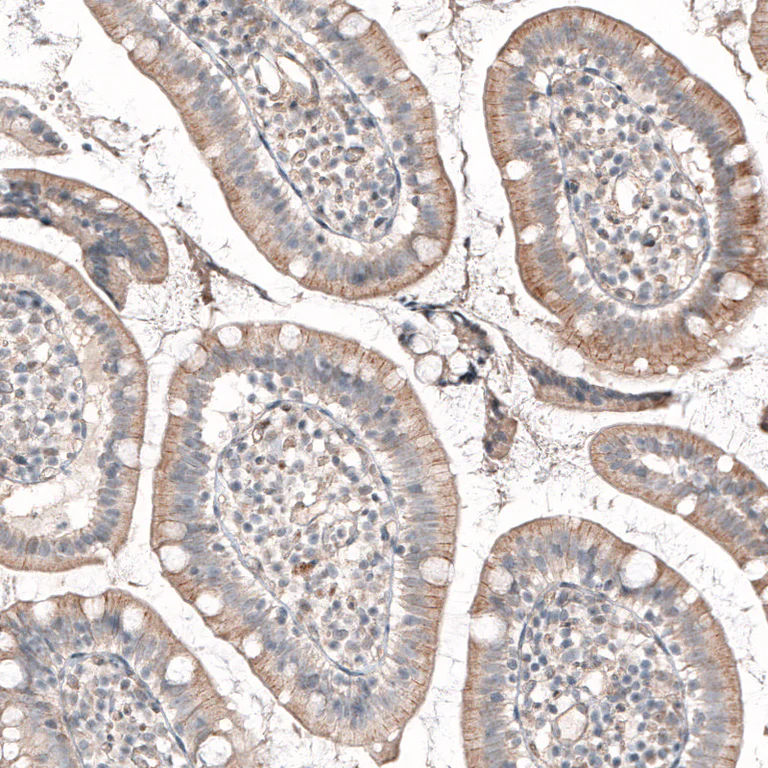 Immunohistochemistry (Formalin/PFA-fixed paraffin-embedded sections) - Anti-ROR2 Antibody [CL5950] (AB327120)