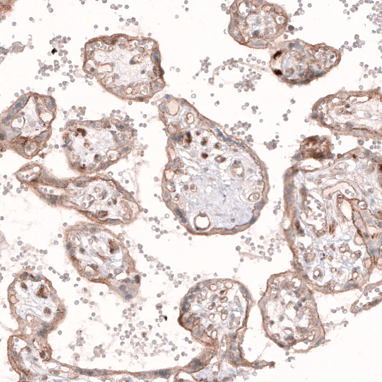 Immunohistochemistry (Formalin/PFA-fixed paraffin-embedded sections) - Anti-ROR2 Antibody [CL5950] (AB327120)