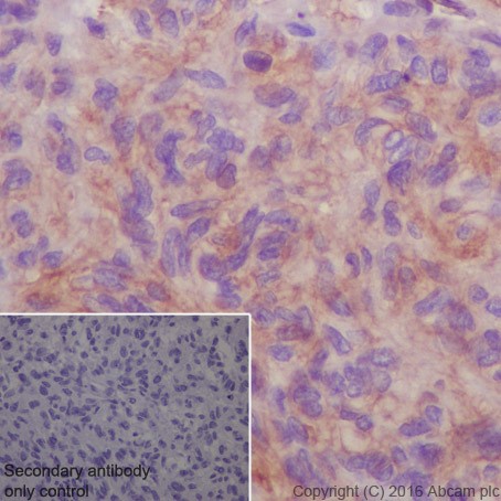 Immunohistochemistry (Formalin/PFA-fixed paraffin-embedded sections) - Anti-ROR2 antibody [EPR19980] (AB218105)