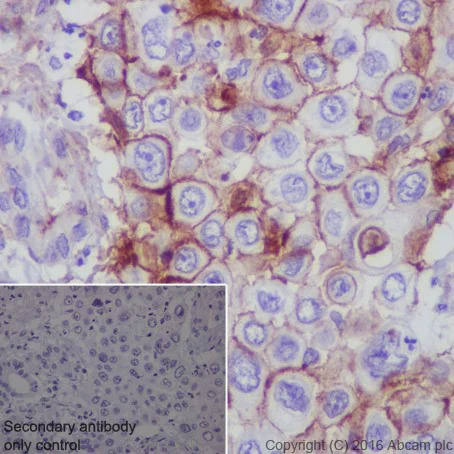 Immunohistochemistry (Formalin/PFA-fixed paraffin-embedded sections) - Anti-ROR2 antibody [EPR19980] (AB218105)