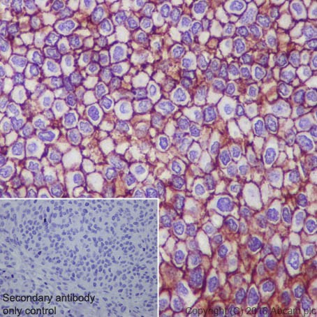 Immunohistochemistry (Formalin/PFA-fixed paraffin-embedded sections) - Anti-ROR2 antibody [EPR19980] (AB218105)