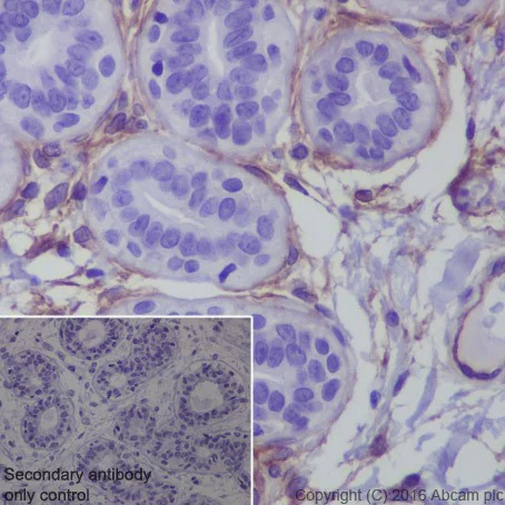 Immunohistochemistry (Formalin/PFA-fixed paraffin-embedded sections) - Anti-ROR2 antibody [EPR19980] - BSA and Azide free (AB251556)