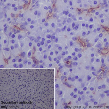 Immunohistochemistry (Formalin/PFA-fixed paraffin-embedded sections) - Anti-ROR2 antibody [EPR19980] - BSA and Azide free (AB251556), expandable thumbnail