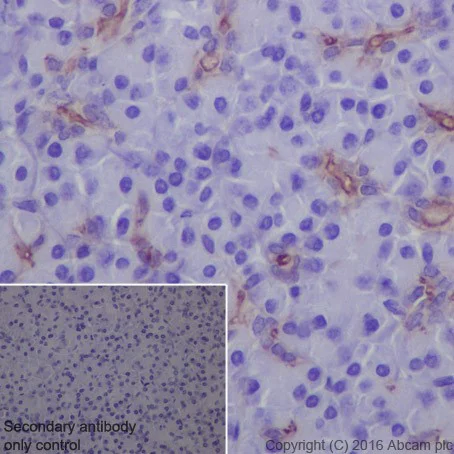 Immunohistochemistry (Formalin/PFA-fixed paraffin-embedded sections) - Anti-ROR2 antibody [EPR19980] - BSA and Azide free (AB251556)