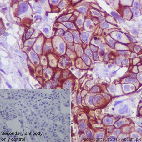 Immunohistochemistry (Formalin/PFA-fixed paraffin-embedded sections) - Anti-ROR2 antibody [EPR19980] - BSA and Azide free (AB251556)
