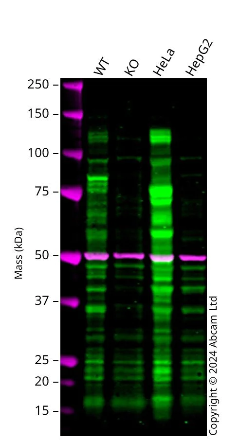 Western blot - Anti-ROR2 antibody [EPR19980] - BSA and Azide free (AB251556)
