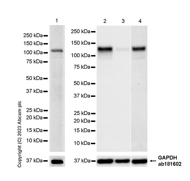 Western blot - Anti-ROR2 antibody [EPR27134-21] (AB309483)