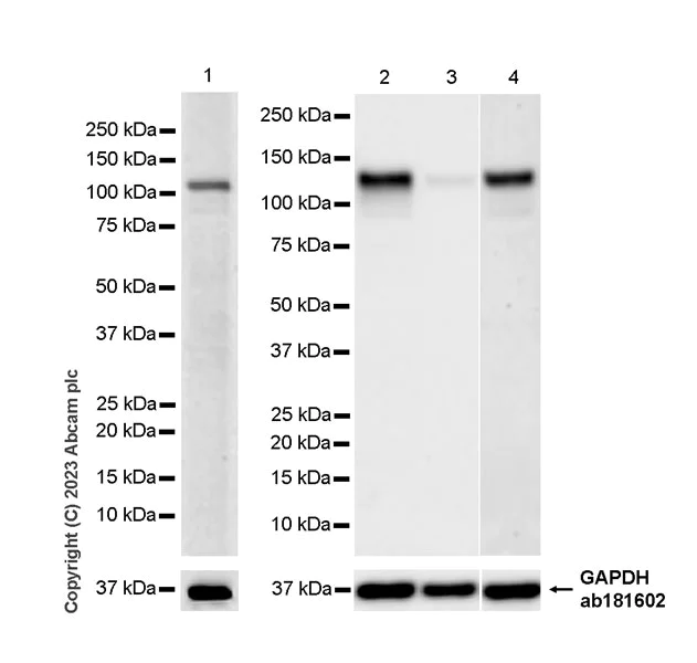 Western blot - Anti-ROR2 antibody [EPR27134-21] (AB309483)
