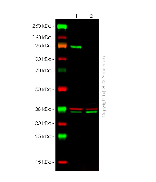 Western blot - Anti-ROR2 antibody [EPR27134-21] (AB309483)