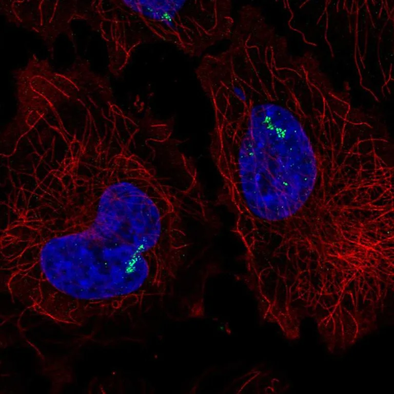 Immunocytochemistry/ Immunofluorescence - Anti-RORC Antibody (AB327262)