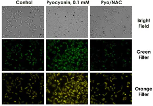 Fluorescence Microscopy - ROS/Superoxide Detection Assay Kit (Cell-based) (AB139476)