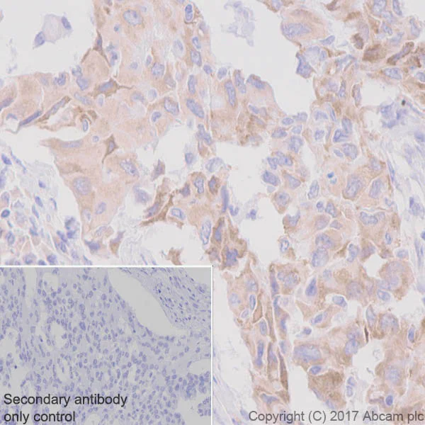 Immunohistochemistry (Formalin/PFA-fixed paraffin-embedded sections) - Anti-ROS1 antibody [EPMGHR2] - BSA and Azide free (AB238986)